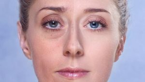 Как быстро и эффективно избавиться от отёков на лице