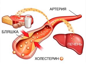 Опасность холестерина: важные факты для здоровья сердца и сосудов
